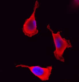 PAK1 was detected in immersion fixed HeLa human cervical epithelial carcinoma cell line using Goat Anti-Human PAK1 Antigen Affinity-purified Polyclonal Antibody (Catalog # AF7495) at 15 µg/mL for 3 hours at room temperature. Cells were stained using the NorthernLights™ 557-conjugated Anti-Goat IgG Secondary Antibody (red; Catalog # NL001) and counterstained with DAPI (blue). Specific staining was localized to cytoplasm. View our protocol for Fluorescent ICC Staining of Cells on Coverslips.