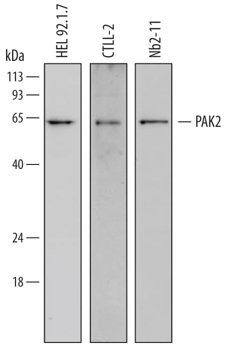 Western blot shows lysates of HEL 92.1.7 human erythroleukemic cell line, CTLL-2 mouse cytotoxic T cell line, and Nb2-11 rat lymphoma cell line. PVDF membrane was probed with 2 µg/mL of Mouse Anti-Human PAK2 Monoclonal Antibody (Catalog # MAB6849) followed by HRP-conjugated Anti-Mouse IgG Secondary Antibody (Catalog # HAF007). A specific band was detected for PAK2 at approximately 63 kDa (as indicated). This experiment was conducted under reducing conditions and using Immunoblot Buffer Group 1.