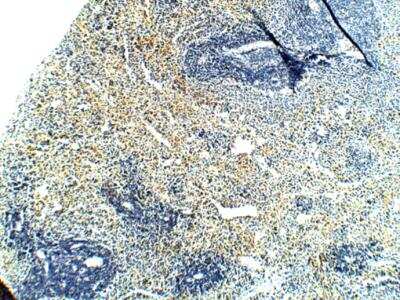 Immunohistochemistry-Paraffin: PAR2 Antibody [NBP2-11250] - 1:100 dilution in IHC blocking buffer.  DAB (brown staining and Hematoxlyn QS (blue) counsterstain. FFPE section