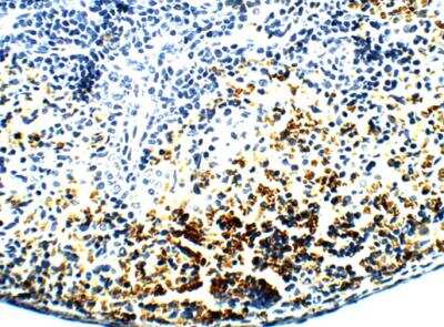 Immunohistochemistry-Paraffin: PAR2 Antibody [NBP2-11250] - 1:100 dilution in IHC blocking buffer. DAB (brown) staining and Hematoxylin QS (blue) counterstain. 40X magnification.  