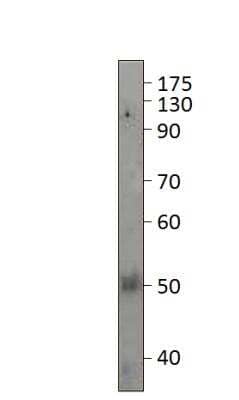 Western Blot: PAR2 Antibody [NBP2-11250] - 1:500 antibody dilution in DiluObuffer. Apparent MW is 50 KDa.