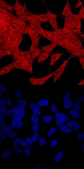 PAWR was detected in immersion fixed LNCaP human prostate cancer cell line using Sheep Anti-Human PAWR Antigen Affinity-purified Polyclonal Antibody (Catalog # AF6885) at 10 µg/mL for 3 hours at room temperature. Cells were stained using the NorthernLights™ 557-conjugated Anti-Sheep IgG Secondary Antibody (red, upper panel; Catalog # NL010) and counterstained with DAPI (blue, lower panel). Specific staining was localized to cell surfaces and cytoplasm. View our protocol for Fluorescent ICC Staining of Cells on Coverslips.