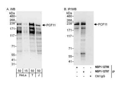 Western Blot: PCF11 Antibody [NBP2-12787] - Detection of human PCF11 by western blot and immunoprecipitation. Samples: Whole cell lysate from HeLa (15 and 50 ug for WB; 1 mg for IP, 20% of IP loaded), HEK293T (T; 50 ug) and Jurkat (J; 50 ug) cells. Antibodies: Affinity purified rabbit anti-PCF11 antibody NBP2-12787 used for WB at 0.1 ug/ml (A) and 1 ug/ml (B) and used for IP at 6 ug/mg lysate. PCF11 was also immunoprecipitated by rabbit anti-PCF11 antibody NBP2-12786, which recognizes an upstream epitope. Detection: Chemiluminescence with exposure times of 30 seconds (A) and 3 seconds (B).