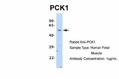 Western Blot: PCK1 Antibody [NBP1-54825] - Human Fetal Muscle, Antibody Dilution: 1.0 ug/ml.