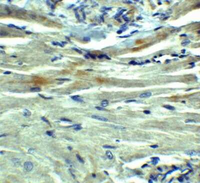 Immunohistochemistry-Paraffin: PD-L1 Antibody [NBP1-76769] - PD-L1/B7-H1 Antibody [NBP1-76769] - PD-L1 in rat heart tissue with  at 5 ug/mL.