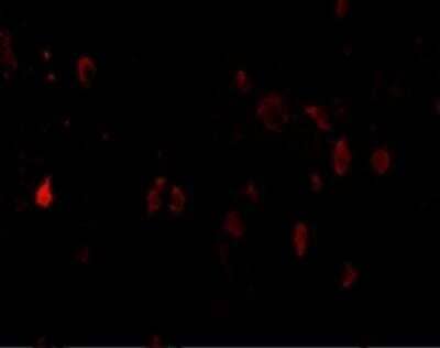 Immunocytochemistry/Immunofluorescence: PD-L2/B7-DC/PDCD1LG2 Antibody [NBP1-76770] - analysis of 4% paraformaldehydefixed mouse brain cells labeling PD-L2 with this antibody at 20ug/mL, followed by goat anti-rabbit IgG secondaryantibody at 1/500 dilution (red).