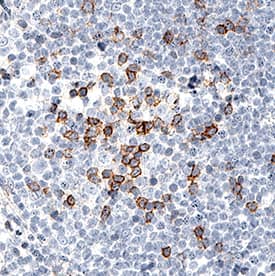     PD‑1  was detected in immersion fixed paraffin-embedded sections of human tonsil  using Mouse Anti-Human PD‑1 Monoclonal Antibody (Catalog #  MAB10864) at 5 µg/mL for 1 hour at room temperature  followed by incubation with the Anti-Mouse IgG VisUCyte™ HRP  Polymer Antibody (Catalog # VC001).  Before incubation with the primary antibody, tissue was subjected to  heat-induced epitope retrieval using Antigen Retrieval Reagent-Basic (Catalog  # CTS013).  Tissue was stained using DAB (brown) and counterstained with hematoxylin  (blue). Specific staining was localized to lymphocytes. View our protocol for  IHC  Staining with VisUCyte HRP Polymer Detection Reagents. 