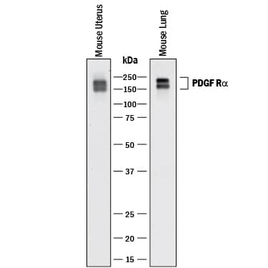 PDGFR alpha Antibody [Unconjugated] (AF1062): Novus Biologicals