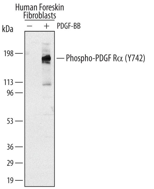 Western blot shows lysates of human foreskin fibroblast untreated (-) or treated (+) with 100 ng/mL Recombinant Human PDGF-BB (Catalog # 220-BB) for 10 minutes. PVDF membrane was probed with 0.5 µg/mL of Human Phospho-PDGF R alpha  (Y742) Antigen Affinity-purified Polyclonal Antibody (Catalog # AF2114), followed by HRP-conjugated Anti-Rabbit IgG Secondary Antibody (Catalog # HAF008). A specific band was detected for Phospho-PDGF R alpha  (Y742) at approximately 190 kDa (as indicated). This experiment was conducted under reducing conditions and using Immunoblot Buffer Group 1.