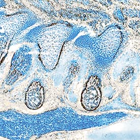 PDGF Ra was detected in immersion fixed frozen sections of mouse embryo (13 d.p.c.) using Goat Anti-Mouse PDGF Ra Biotinylated Antigen Affinity-purified Polyclonal Antibody (Catalog # BAF1062) at 15 µg/mL overnight at 4 °C. Tissue was stained using the Anti-Goat HRP-DAB Cell & Tissue Staining Kit (brown; Catalog # CTS008) and counterstained with hematoxylin (blue). Specific staining was localized to developing cartilage. View our protocol for Chromogenic IHC Staining of Frozen Tissue Sections.