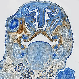 PDGF R beta  was detected in immersion fixed frozen sections of mouse embryo (13 d.p.c.) using Goat Anti-Mouse PDGF R beta  Biotinylated Antigen Affinity-purified Polyclonal Antibody (Catalog # BAF1042) at 15 µg/mL overnight at 4 °C. Tissue was stained using the Anti-Goat HRP-DAB Cell & Tissue Staining Kit (brown; Catalog # CTS008) and counterstained with hematoxylin (blue). Specific staining was localized to developing brain. View our protocol for Chromogenic IHC Staining of Frozen Tissue Sections.