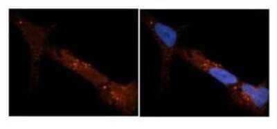 Immunocytochemistry/Immunofluorescence: PDIA6 Antibody [NBP1-57999] - NT2 cells Red: Antibody Blue: DAPI Primary Dilution: 1ug/50ul antibody Secondary Antibody: Alexa goat anti-rabbit 594 Image Submitted by:  Yuzhi Chen, University of Arkansas for Medical Sciences