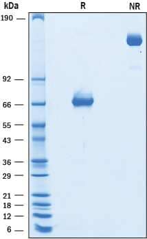 2 μg/lane of Recombinant Mouse PD‑L2/B7‑DC (K113S) was resolved with SDS-PAGE underreducing (R) and non-reducing (NR) conditions and visualized by Coomassie® Bluestaining, showing bands at 64-84 kDa and 125-170 kDa, respectively.