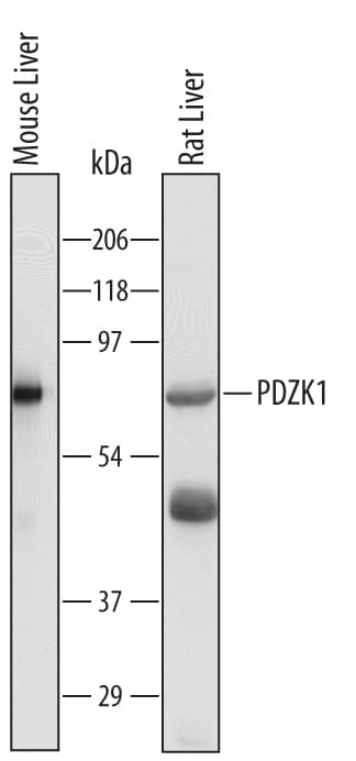 Western blot shows lysates of mouse liver tissue and rat liver tissue. PVDF Membrane was probed with 1 µg/mL of Goat Anti-Mouse/Rat PDZK1 Antigen Affinity-purified Polyclonal Antibody (Catalog # AF5780) followed by HRP-conjugated Anti-Goat IgG Secondary Antibody (Catalog # HAF109). A specific band was detected for PDZK1 at approximately 75 kDa (as indicated). This experiment was conducted under reducing conditions and using Immunoblot Buffer Group 1.