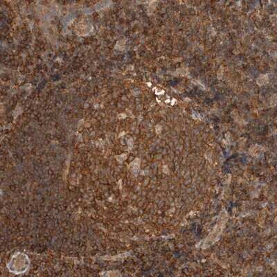 Immunohistochemistry-Paraffin: PFDN4 Antibody [NBP1-88526] - Staining of human tonsil shows strong cytoplasmic positivity in most cells.