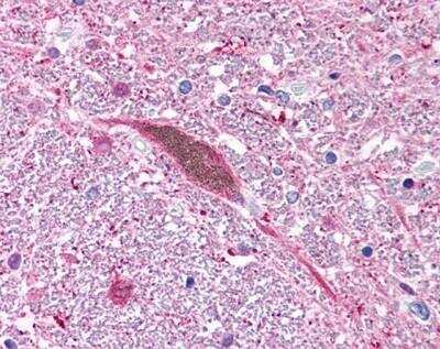 Immunohistochemistry: PGP9.5 / UCHL-1 Antibody [NB300-675] -  Human brain, Substantia Nigra, Pigmented Neuron, 40X.