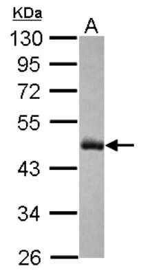 PHF6 Antibody (NBP2-19799): Novus Biologicals