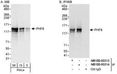 PHF8 Antibody (NB100-93313): Novus Biologicals