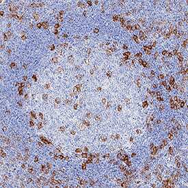     PILR‑ alpha   was detected in immersion fixed paraffin-embedded sections of human tonsil  using Rabbit Anti-Human PILR‑ alpha  Monoclonal Antibody (Catalog #  MAB64841) at 3 µg/mL for 1 hour at room temperature  followed by incubation with the Anti-Rabbit IgG VisUCyte™ HRP  Polymer Antibody (Catalog # VC003).  Tissue was stained using DAB (brown) and counterstained with hematoxylin  (blue).  Specific staining was  localized to dendritic cells. View our protocol for IHC  Staining with VisUCyte HRP Polymer Detection Reagents. 