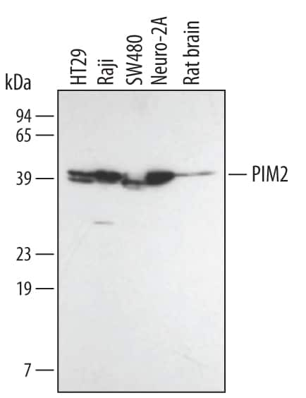 Western blot shows lysates of HT-29 human colon adenocarcinoma cell line, Raji human Burkitt's lymphoma cell line, SW480 human colorectal adenocarcinoma cell line, Neuro-2A mouse neuroblastoma cell line, and rat brain tissue. PVDF membrane was probed with 0.5 µg/mL Mouse Anti-Human/Mouse/Rat PIM2 Monoclonal Antibody (Catalog # MAB4355) followed by HRP-conjugated Anti-Mouse IgG Secondary Antibody (Catalog # HAF007). A specific band for PIM2 was detected at approximately 38 kDa and 40 kDa (as indicated). This experiment was conducted under reducing conditions and using Immunoblot Buffer Group 3.