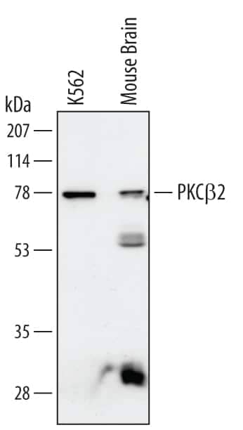 Western blot shows lysates of K562 human chronic myelogenous leukemia cell line and mouse brain tissue. PVDF membrane was probed with 1 µg/mL of Human/Mouse PKC beta 2 Monoclonal Antibody (Catalog # MAB4378) followed by HRP-conjugated Anti‑Mouse IgG Secondary Antibody (Catalog # HAF007). A specific band was detected for PKC beta 2 at approximately 78 kDa (as indicated). This experiment was conducted under reducing conditions and using Immunoblot Buffer Group 1.