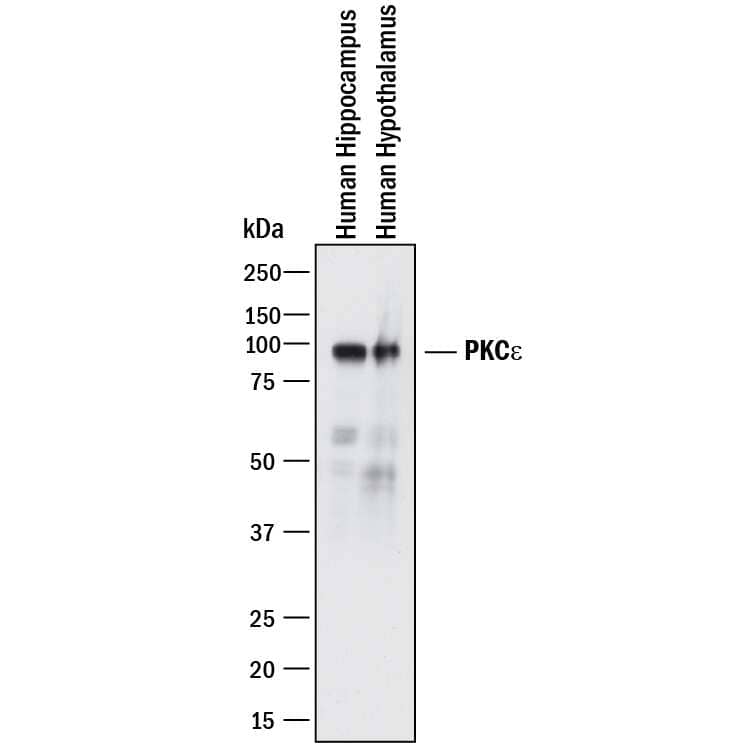 Western blot shows lysates of Human brain (hippocampus) tissue and human brain (hypothalamus) tissue. PVDF membrane was probed with 2 µg/mL of Mouse Anti-Human PKCe Monoclonal Antibody (Catalog # MAB51341) followed by HRP-conjugated Anti-Mouse IgG Secondary Antibody (Catalog # HAF018). A specific band was detected for PKCe at approximately 90 kDa (as indicated). This experiment was conducted under reducing conditions and using Immunoblot Buffer Group 1.