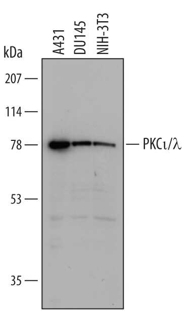 Western blot shows lysates of A431 human epithelial carcinoma cell line, DU145 human prostate carcinoma cell line, and NIH-3T3 mouse embryonic fibroblast cell line. PVDF membrane was probed with 1 µg/mL of Human/Mouse PKC iota/lambda Monoclonal Antibody (Catalog # MAB4465) followed by HRP-conjugated Anti-Mouse IgG Secondary Antibody (Catalog # HAF007). A specific band was detected for PKC iota/lambda at approximately 78 kDa (as indicated). This experiment was conducted under reducing conditions and using Immunoblot Buffer Group 1.