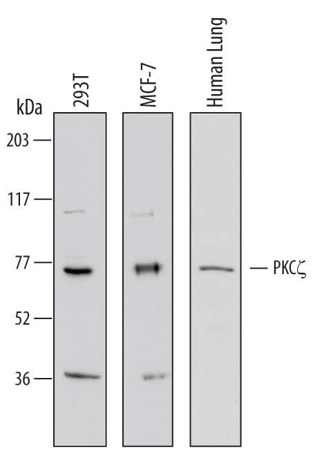 Western blot shows lysates of 293T human embryonic kidney cell line, MCF-7 human breast cancer cell line, and human lung tissue. PVDF Membrane was probed with 1 µg/mL of Human PKC zeta Antigen Affinity-purified Polyclonal Antibody (Catalog # AF6666) followed by HRP-conjugated Anti-Sheep IgG Secondary Antibody (Catalog # HAF016). A specific band was detected for PKC zeta at approximately 75 kDa (as indicated). This experiment was conducted under reducing conditions and using Immunoblot Buffer Group 1.