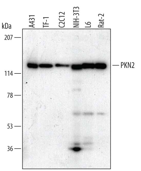 Western blot shows lysates of A431 human epithelial carcinoma cell line, TF-1 human erythroleukemic cell line, C2C12 mouse myoblast cell line, NIH-3T3 mouse embryonic fibroblast cell line, L6 rat myoblast cell line, and Rat-2 rat embryonic fibroblast cell line. PVDF membrane was probed with 1 µg/mL of Human/Mouse/Rat PKN2 Monoclonal Antibody (Catalog # MAB5686) followed by HRP-conjugated Anti-Mouse IgG Secondary Antibody (Catalog # HAF007). A specific band was detected for PKN2 at approximately 140 kDa (as indicated). This experiment was conducted under reducing conditions and using Immunoblot Buffer Group 1.