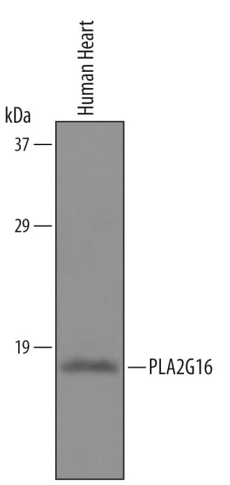Western blot shows lysates of human heart tissue. PVDF Membrane was probed with 1 µg/mL of Sheep Anti-Human PLA2G16 Antigen Affinity-purified Polyclonal Antibody (Catalog # AF6190) followed by HRP-conjugated Anti-Sheep IgG Secondary Antibody (Catalog # HAF016). A specific band was detected for PLA2G16 at approximately 17 kDa (as indicated). This experiment was conducted under reducing conditions and using Immunoblot Buffer Group 8.