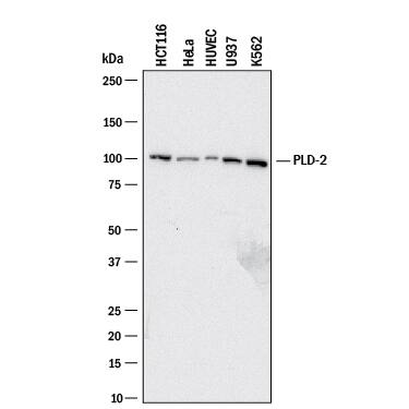 Western blot shows lysates of HCT-116 human colorectal carcinoma cell line, HeLa human cervical epithelial carcinoma cell line, HUVEC human umbilical vein endothelial cells, U937 human histiocytic lymphoma cell line, and K562 human chronic myelogenous leukemia cell line. PVDF membrane was probed with 2 µg/mL of Mouse Anti-Human PLD2 Monoclonal Antibody (Catalog # MAB10123) followed by HRP-conjugated Anti-Mouse IgG Secondary Antibody (Catalog # HAF018). A specific band was detected for PLD2 at approximately 105 kDa (as indicated). This experiment was conducted under reducing conditions and using Immunoblot Buffer Group 1.