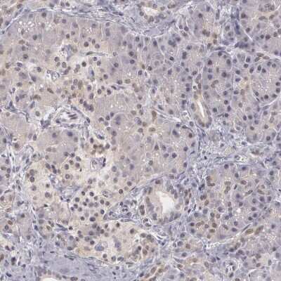 Immunohistochemistry-Paraffin PLZF Antibody