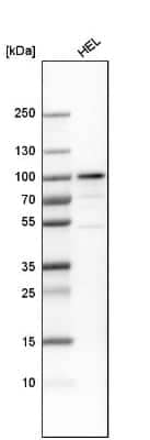 Western Blot PLZF Antibody