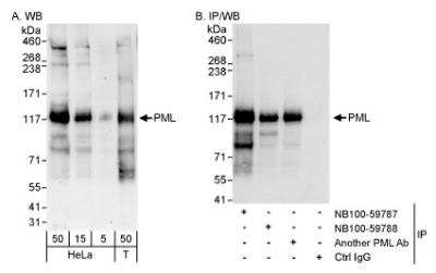 Western Blot PML Protein Antibody