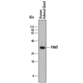 Western blot shows lysates of human adrenal gland tissue. PVDF membrane was probed with 1 µg/mL of Sheep Anti-Human PNMT Antigen Affinity-purified Polyclonal Antibody (Catalog # AF7854) followed by HRP-conjugated Anti-Sheep IgG Secondary Antibody (Catalog # HAF016). A specific band was detected for PNMT at approximately 30 kDa (as indicated). This experiment was conducted under reducing conditions and using Immunoblot Buffer Group 1.