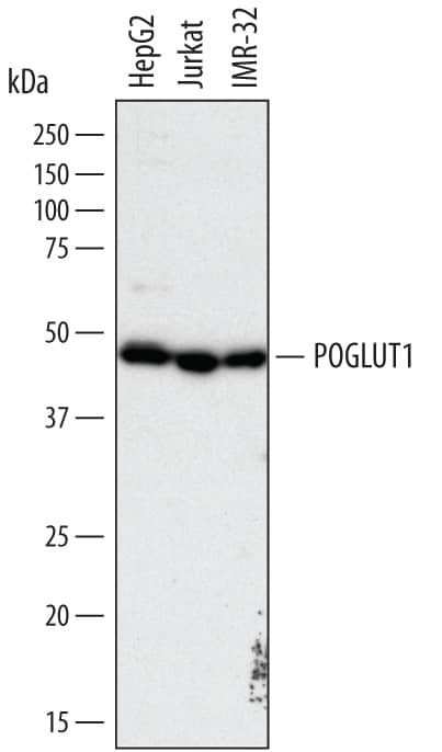 Western blot shows lysates of HepG2 human hepatocellular carcinoma cell line, Jurkat human acute T cell leukemia cell line, and IMR-32 human neuroblastoma cell line. PVDF membrane was probed with 1 µg/mL of Sheep Anti-Human Protein O-Glucosyltransferase 1/POGLUT1 Antigen Affinity-purified Polyclonal Antibody (Catalog # AF6437) followed by HRP-conjugated Anti-Sheep IgG Secondary Antibody (Catalog # HAF016). A specific band was detected for Protein O-Glucosyltransferase 1/POGLUT1 at approximately 46 kDa (as indicated). This experiment was conducted under reducing conditions and using Immunoblot Buffer Group 1.