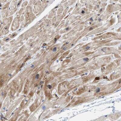 Immunohistochemistry-Paraffin: POLG2 Antibody [NBP1-83227] - Staining of human heart muscle shows cytoplasmic positivity.