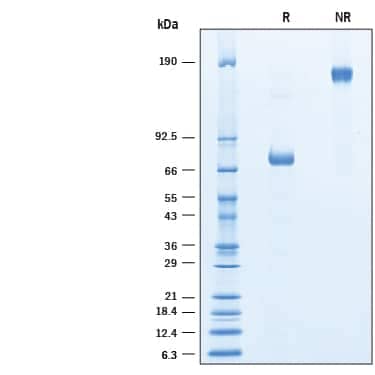 2 μg/lane of Recombinant Human PON1 His-tag Fc Chimera was resolved with SDS-PAGE under reducing (R) and non-reducing (NR) conditions and visualized by Coomassie® blue staining, showing a band at ~74 kDa under reducing conditions.