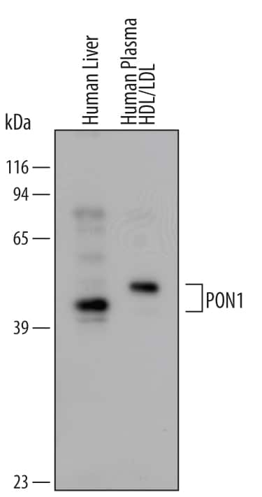 Western blot shows lysates of human liver tissue . PVDF membrane was probed with 0.5 µg/mL Goat Anti-Human PON1 Antigen Affinity-purified Polyclonal Antibody (Catalog # AF5816) followed by HRP-conjugated Anti-Goat IgG Secondary Antibody (Catalog # HAF017). For additional reference, an enriched HDL/LDL fraction obtained from ultracentrifugation of human plasma was included. A specific band for PON1 was detected at approximately 43 kDa (as indicated). This experiment was conducted under reducing conditions and using Immunoblot Buffer Group 2.