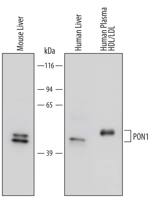 Western blot shows lysates of mouse liver tissue, human liver tissue and an enriched HDL/LDL fraction of human plasma obtained from ultracentrifugation. PVDF membrane was probed with 0.5 µg/mL of Human/Mouse PON1 Monoclonal Antibody (Catalog # MAB4926) followed by HRP-conjugated Anti-Rat IgG Secondary Antibody (Catalog # HAF005). A specific band was detected for PON1 at approximately 43 kDa (as indicated). This experiment was conducted under reducing conditions and using Immunoblot Buffer Group 2.