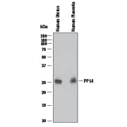 Western blot shows lysates of human uterus tissue and human placenta tissue. PVDF membrane was probed with 2 µg/mL of Mouse Anti-Human PP14/Glycodelin Monoclonal Antibody (Catalog # MAB842) followed by HRP-conjugated Anti-Mouse IgG Secondary Antibody (Catalog # HAF018). A specific band was detected for PP14/Glycodelin at approximately 28 kDa (as indicated). This experiment was conducted under reducing conditions and using Immunoblot Buffer Group 1.