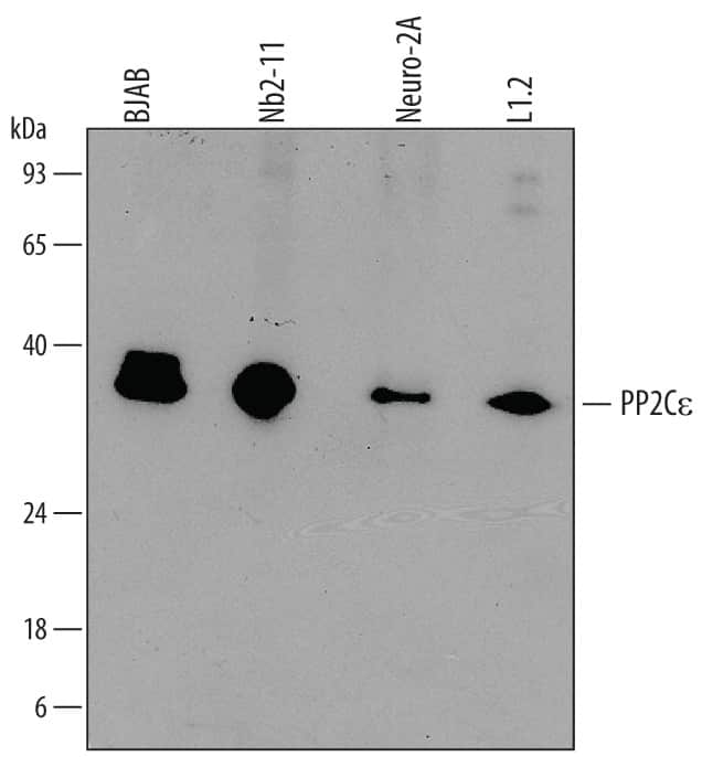 Western Blot PP2C epsilon/PPM1L Antibody (700612)