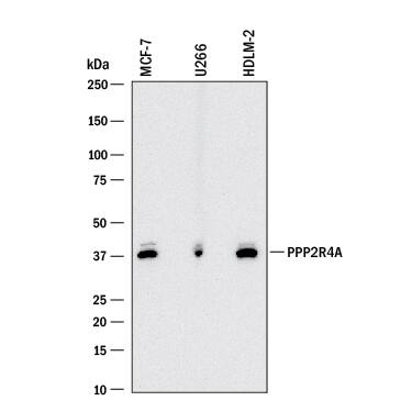 Western blot shows lysates of MCF-7 human breast cancer cell line, U266 human myeloma cell line, and HDLM-2 human Hodgkin's lymphoma cell line. PVDF membrane was probed with 1 µg/mL of Goat Anti-Human PPP2R4 Antigen Affinity-purified Polyclonal Antibody (Catalog # AF5929) followed by HRP-conjugated Anti-Goat IgG Secondary Antibody (Catalog # HAF017). A specific band was detected for PPP2R4 at approximately 40 kDa (as indicated). This experiment was conducted under reducing conditions and using Immunoblot Buffer Group 1.