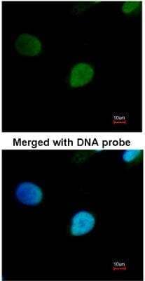 PRP19 Antibody (NBP1-31354): Novus Biologicals