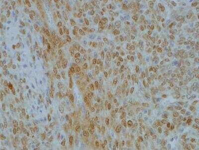 Immunohistochemistry-Paraffin: PRRX1 Antibody [NBP2-13816] - Image provided via verified customer review.