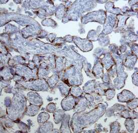 PSG was detected in immersion fixed paraffin-embedded sections of human placenta using Mouse Anti-Human PSG Pan Specific Mono-clonal Antibody (Catalog # MAB6799) at 15 µg/mL overnight at 4 °C. Tissue was stained using the Anti-Mouse HRP-DAB Cell & Tissue Staining Kit (brown; Catalog # CTS002) and counterstained with hematoxylin (blue). Specific staining was localized to cytotrophoblast cells. View our protocol for Chromogenic IHC Staining of Paraffin-embedded Tissue Sections.