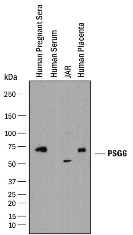 Western blot shows human pregnancy serum, human serum (non-pregnancy), JAR human choriocarcinoma cell line lysates, and human placenta tissue lysates. PVDF membrane was probed with 1:1000 dilution of Rabbit Anti-Human PSG6 Antigen Affinity-purified Polyclonal Antibody (Catalog # AF8598) followed by HRP-conjugated Anti-Rabbit IgG Secondary Antibody (Catalog # HAF008). Specific bands were detected for PSG6 at approximately 55 and 74 kDa (as indicated). This experiment was conducted under reducing conditions and using Immunoblot Buffer Group 1.