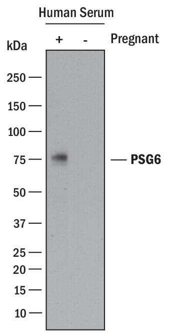 Western Blot PSG6 Antibody (935926) [Unconjugated]