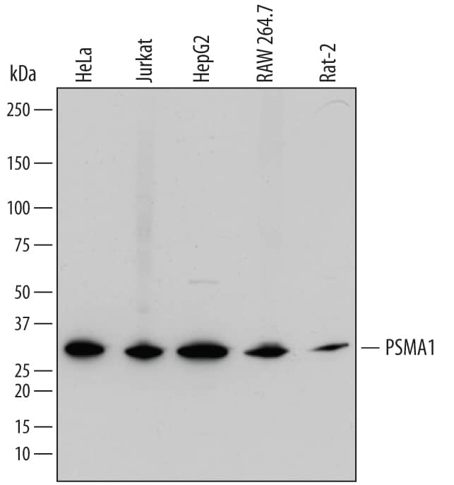 Western blot shows lysates of HeLa human cervical epithelial carcinoma cell line, Jurkat human acute T cell leukemia cell line, HepG2 human hepatocellular carcinoma cell line, RAW 264.7 mouse monocyte/macrophage cell line, and Rat-2 rat embryonic fibroblast cell line. PVDF membrane was probed with 0.5 µg/mL of Sheep Anti-Human/Mouse/Rat PSMA1 Antigen Affinity-purified Polyclonal Antibody (Catalog # AF7565) followed by HRP-conjugated Anti-Sheep IgG Secondary Antibody (Catalog # HAF016). A specific band was detected for PSMA1 at approximately 30 kDa (as indicated). This experiment was conducted under reducing conditions and using Immunoblot Buffer Group 1.