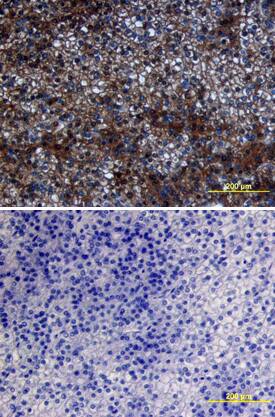 Immunohistochemistry PTEN Antibody [Unconjugated]